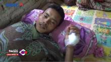 Digigit Buaya Rawa, Tangan Warga Lampung Terluka Parah