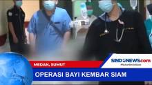 Operasi Bayi Kembar Siam Libatkan 50 Dokter, Berhasil Dipisahkan
