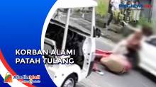 Selebgram Cantik Nuliah Wijaya Terlibat Kecelakaan di Bali