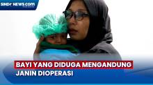 Diduga Mengandung Janin, Bayi 5 Bulan Berhasil Dioperasi di Padang