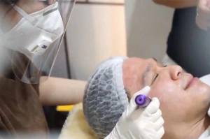 Derma Repair Cell, Metode Baru untuk Atasi Scar Kulit Wajah