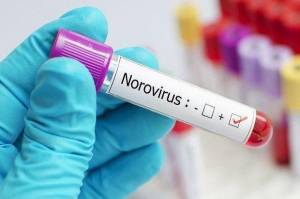 Norovirus  Menyebar dengan Mudah lewat Makanan