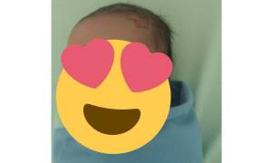 Warganet Geger, Bayi Baru Lahir Punya Tanda Mirip Logo Petir di Bagian Kening