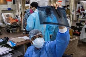Pandemi Covid-19 Belum Selesai, India Diserang Infeksi Jamur Hitam