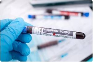 Virus Marburg Bisa Bertahan di Janin, ASI hingga Sperma Selama 7 Minggu