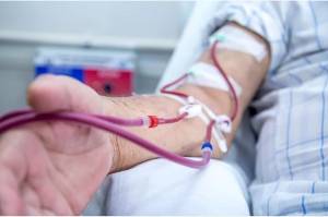 Ini 13 Efek Samping Cuci Darah