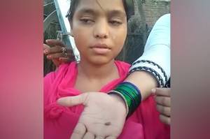 Seorang Gadis Viral Keluarkan Batu dari Matanya, Begini Respons Dokter di India