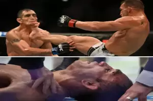 Petarung UFC Ini Wajahnya Rusak Ditendang, Kondisi Tony Ferguson Mengejutkan