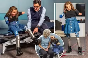 Gadis Kecil Ini Menjadi Orang Termuda yang Memakai Kaki Robot