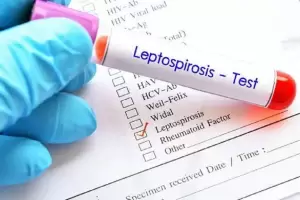 Hati-Hati, Leptospirosis Bisa Akibatkan Gangguan Pernapasan hingga Radang di Selaput Otak