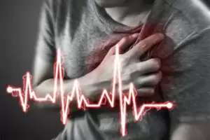 Mengenal Metode Primary PCI, Penanganan Darurat untuk Pasien Serangan Jantung