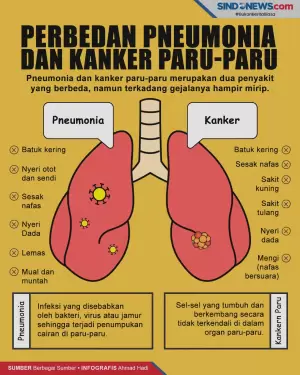 Simak! Ini Perbedaan Antara Pneumonia dan Kanker Paru-Paru