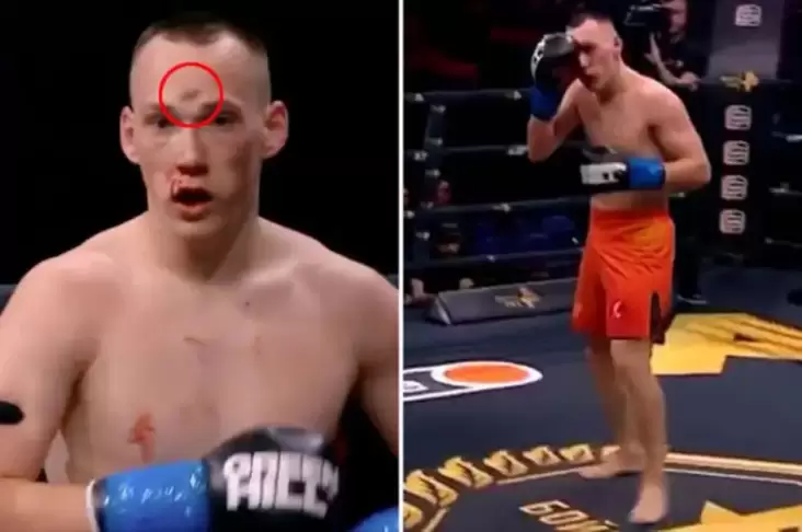 Kickboxer Danil Sharov Alami Retak Tengkorak Mengerikan Terkena Sodokan Lutut